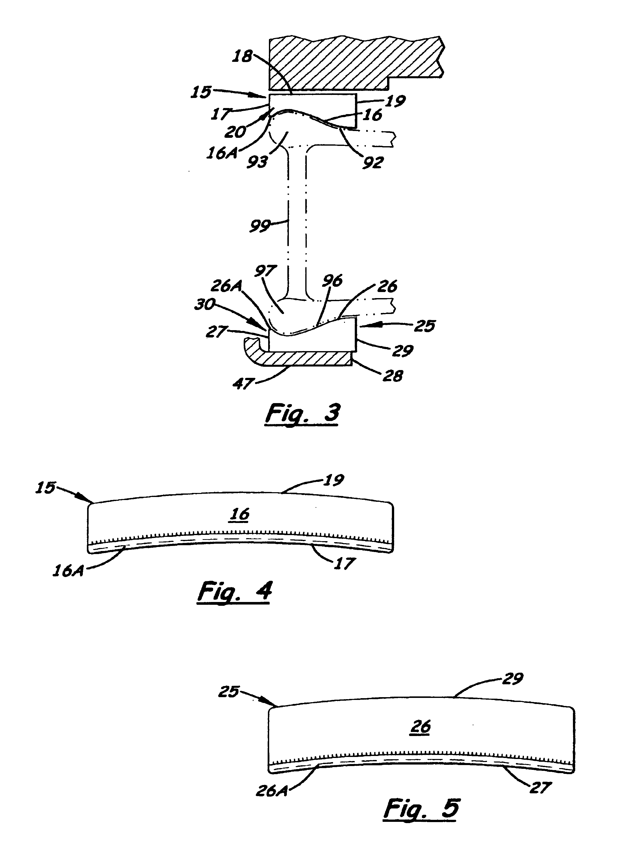 String instrument chinrest pad system