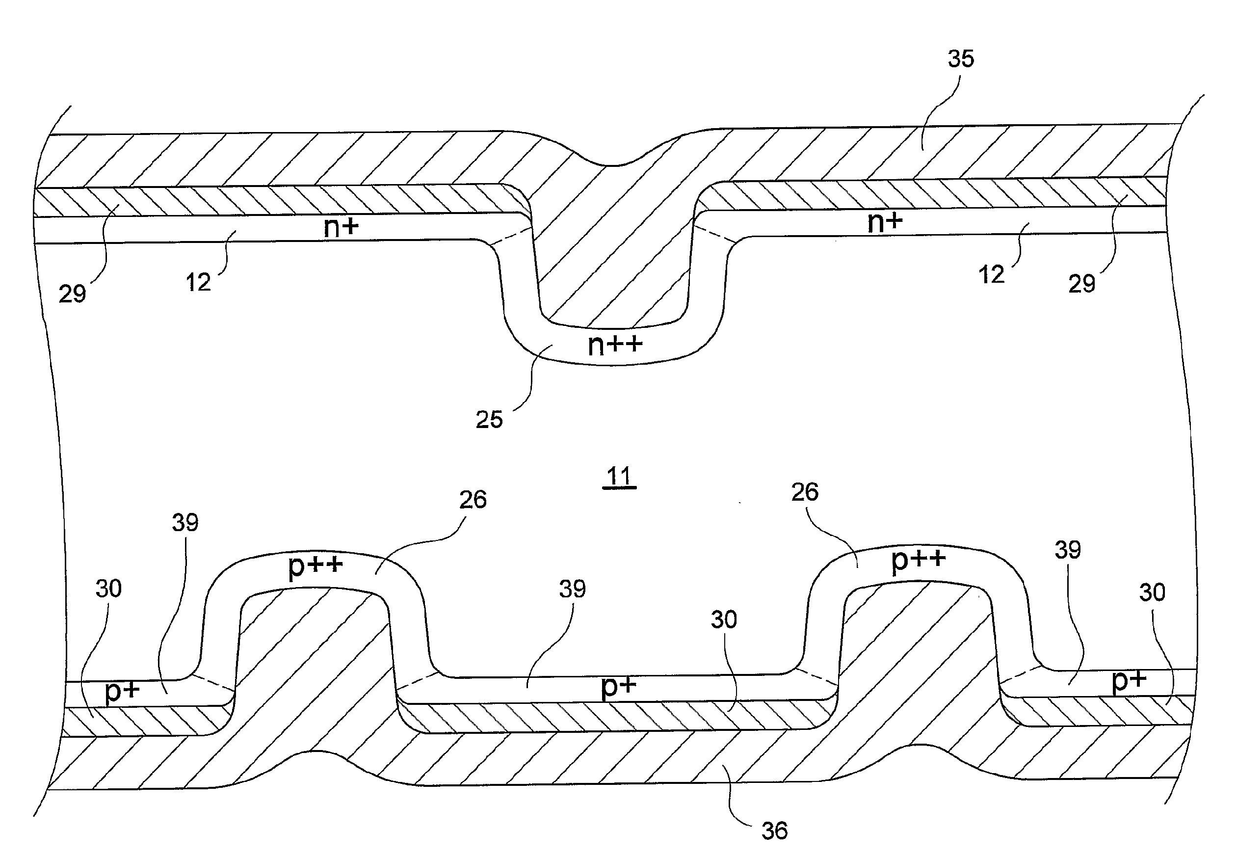 Low area screen printed metal contact structure and method