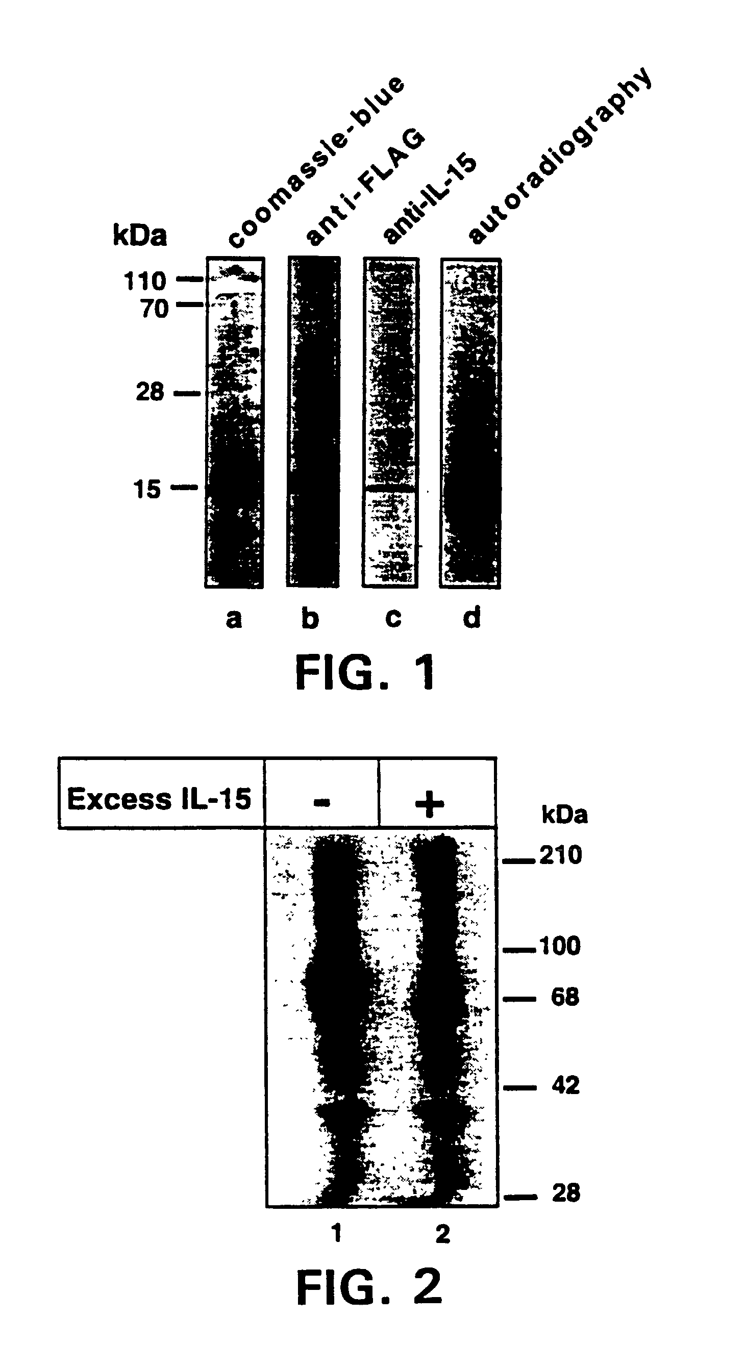 Nucleic acids encoding antagonists of interleukin-15