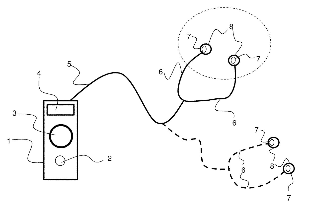 Transcutaneous electrostimulator and methods for electric stimulation