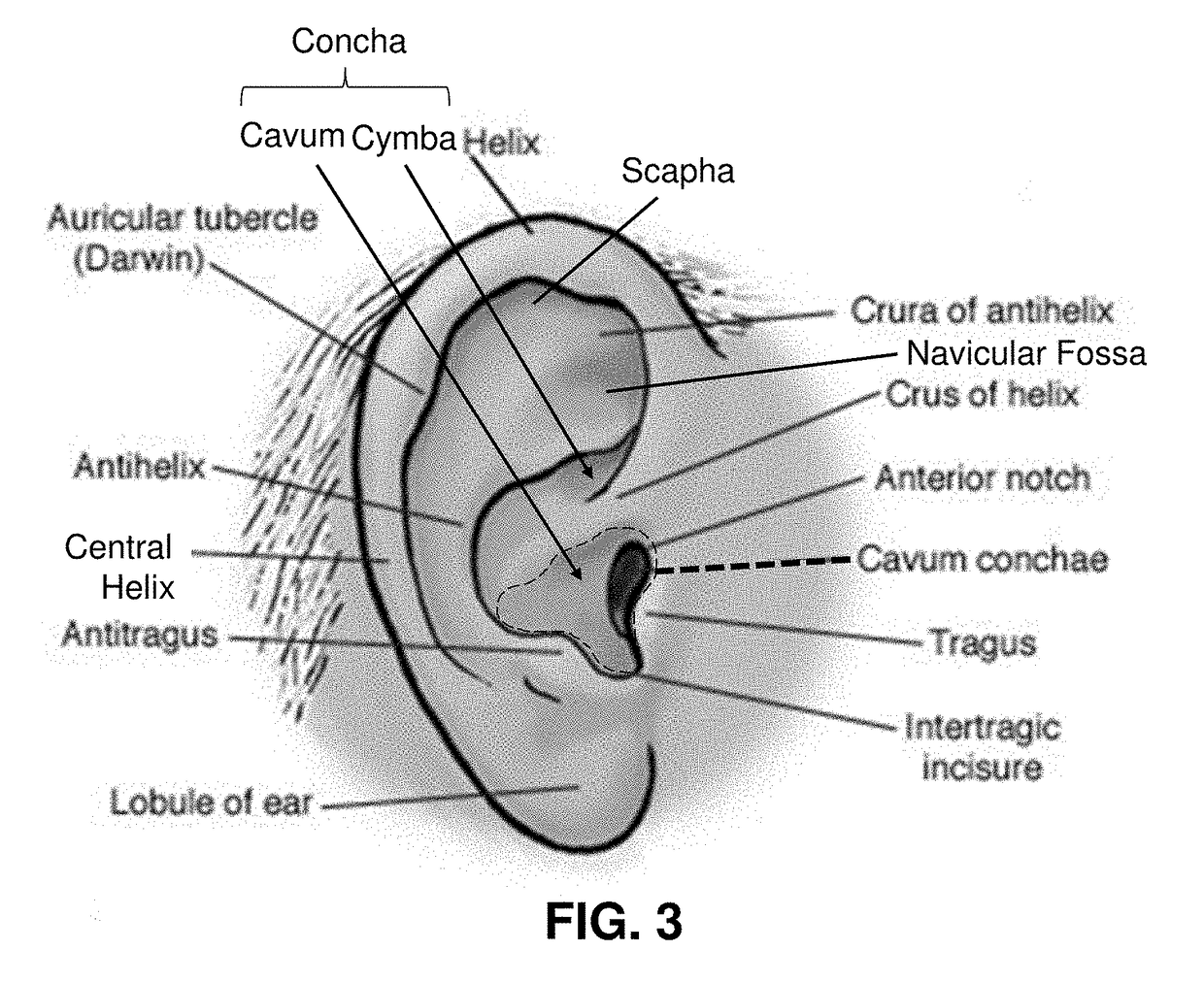 Transcutaneous electrostimulator and methods for electric stimulation