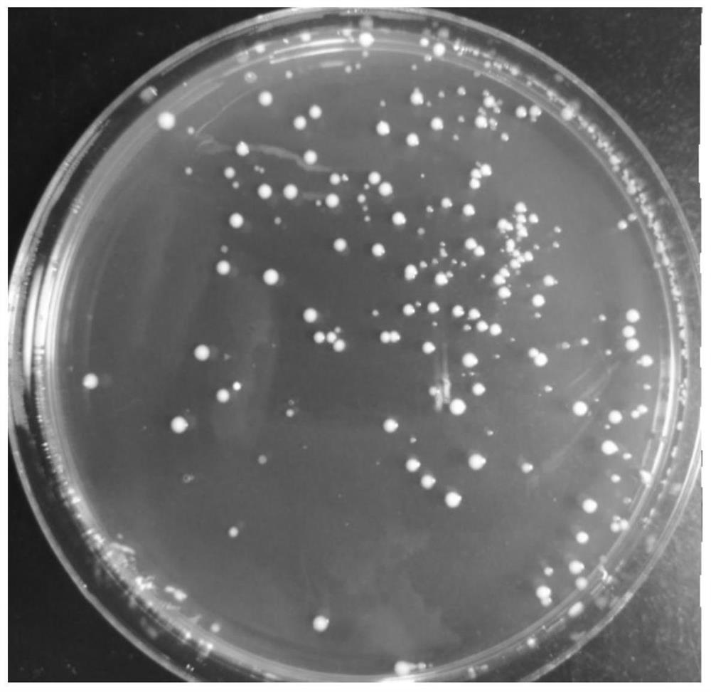 A strain of Lactobacillus fermentum that can reduce blood uric acid