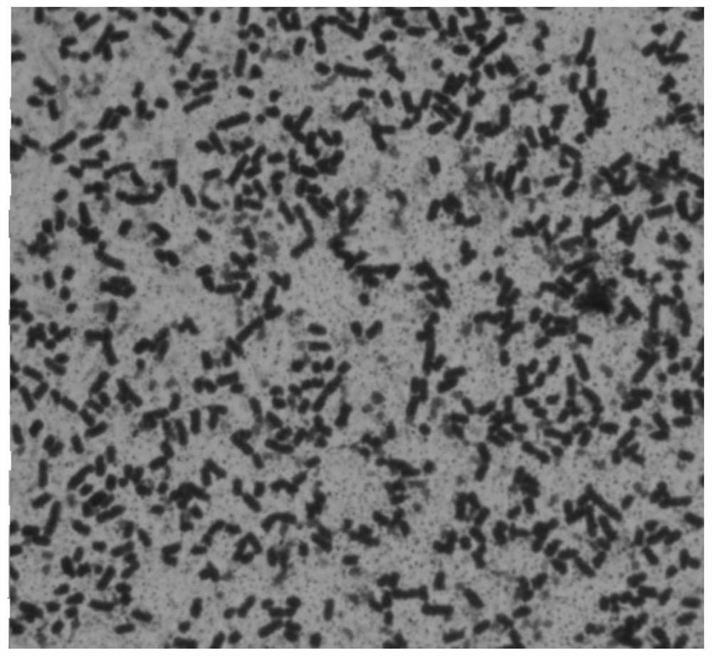 A strain of Lactobacillus fermentum that can reduce blood uric acid