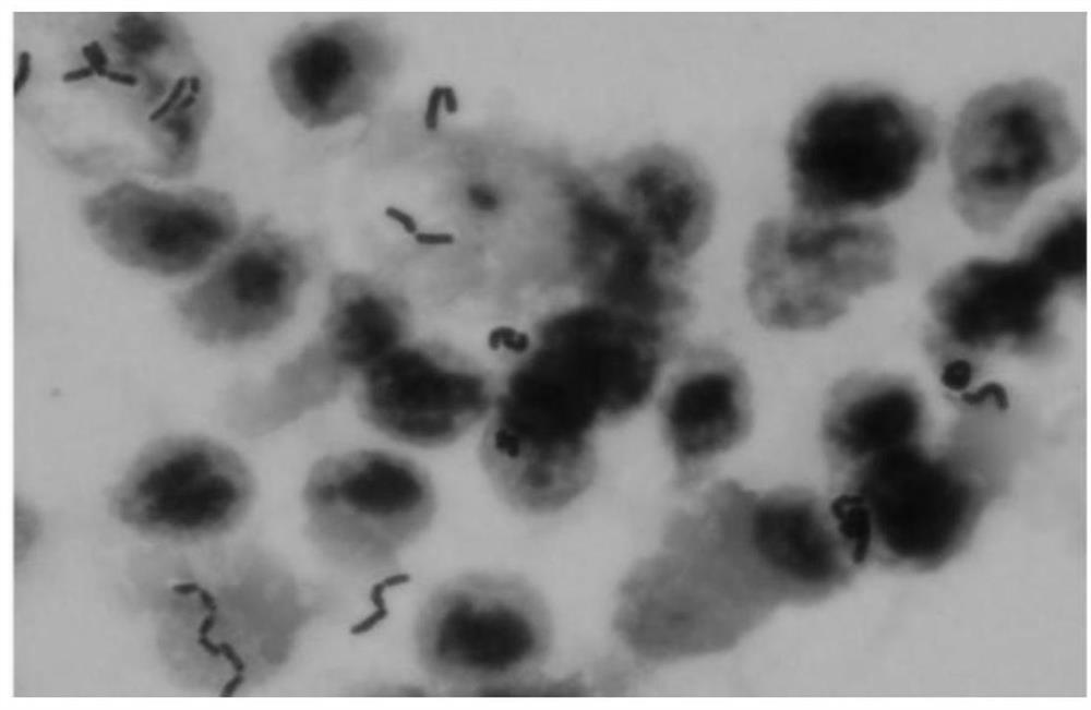 A strain of Lactobacillus fermentum that can reduce blood uric acid