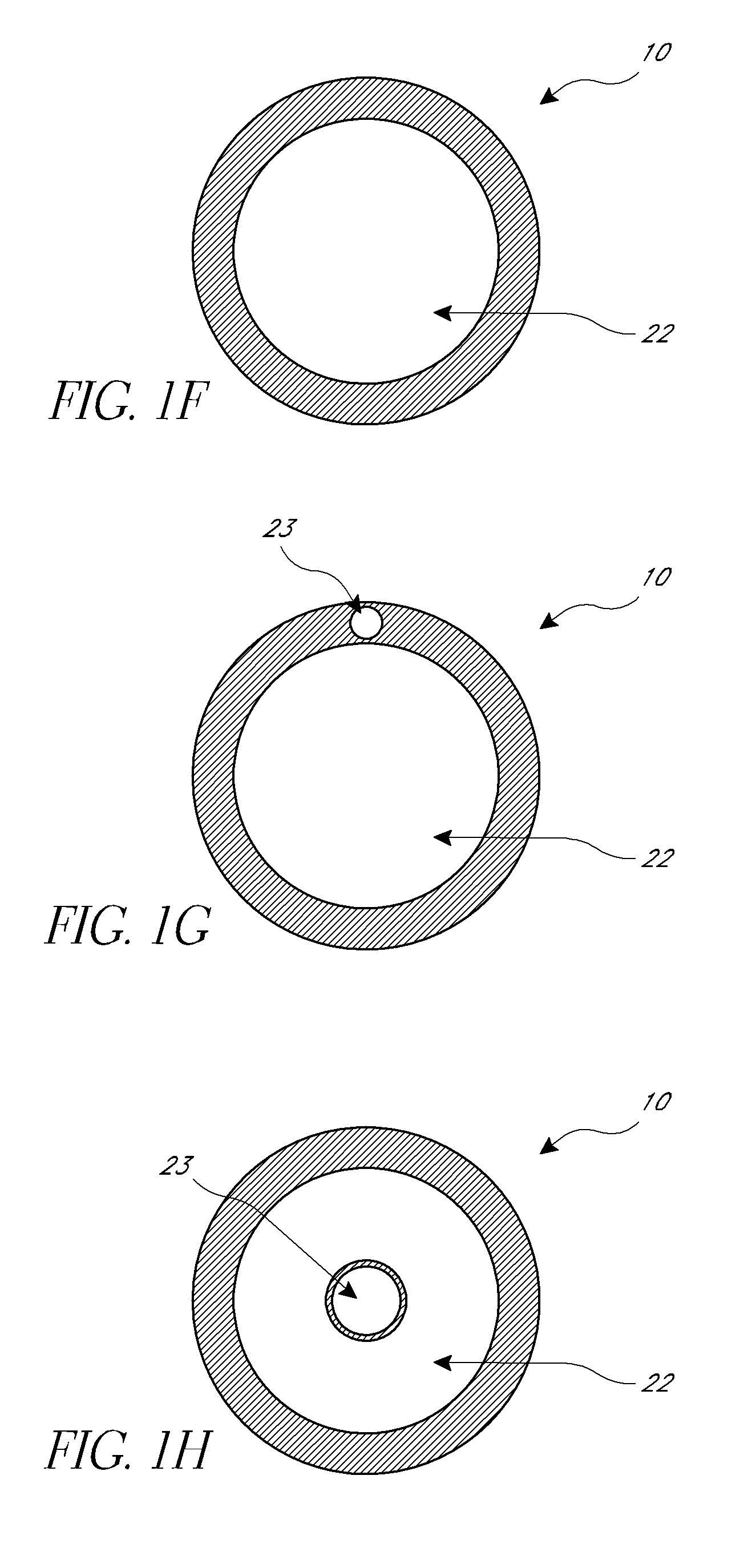 Method and apparatus for treatment of intracranial hemorrhages