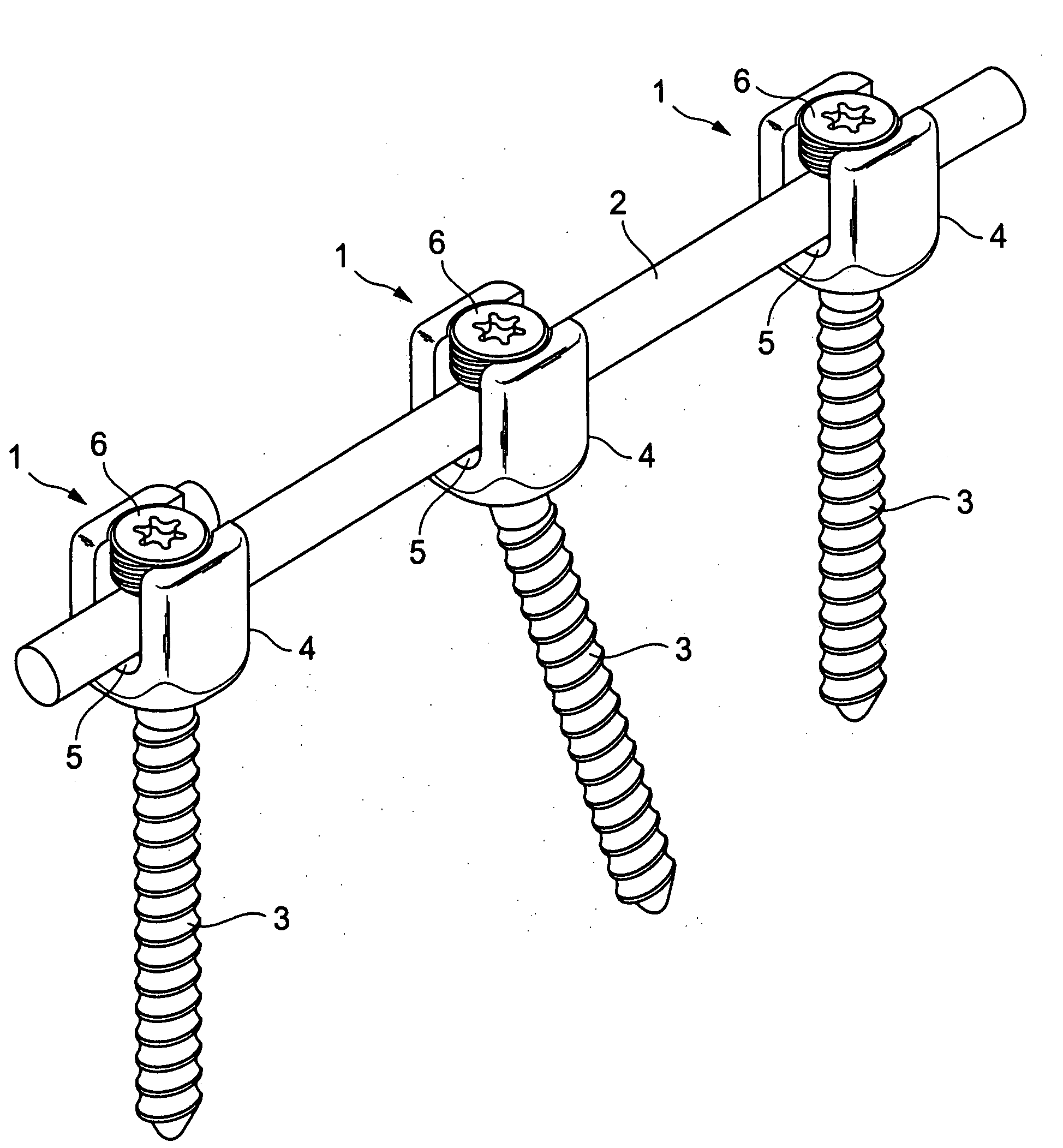 Vertebra connection member