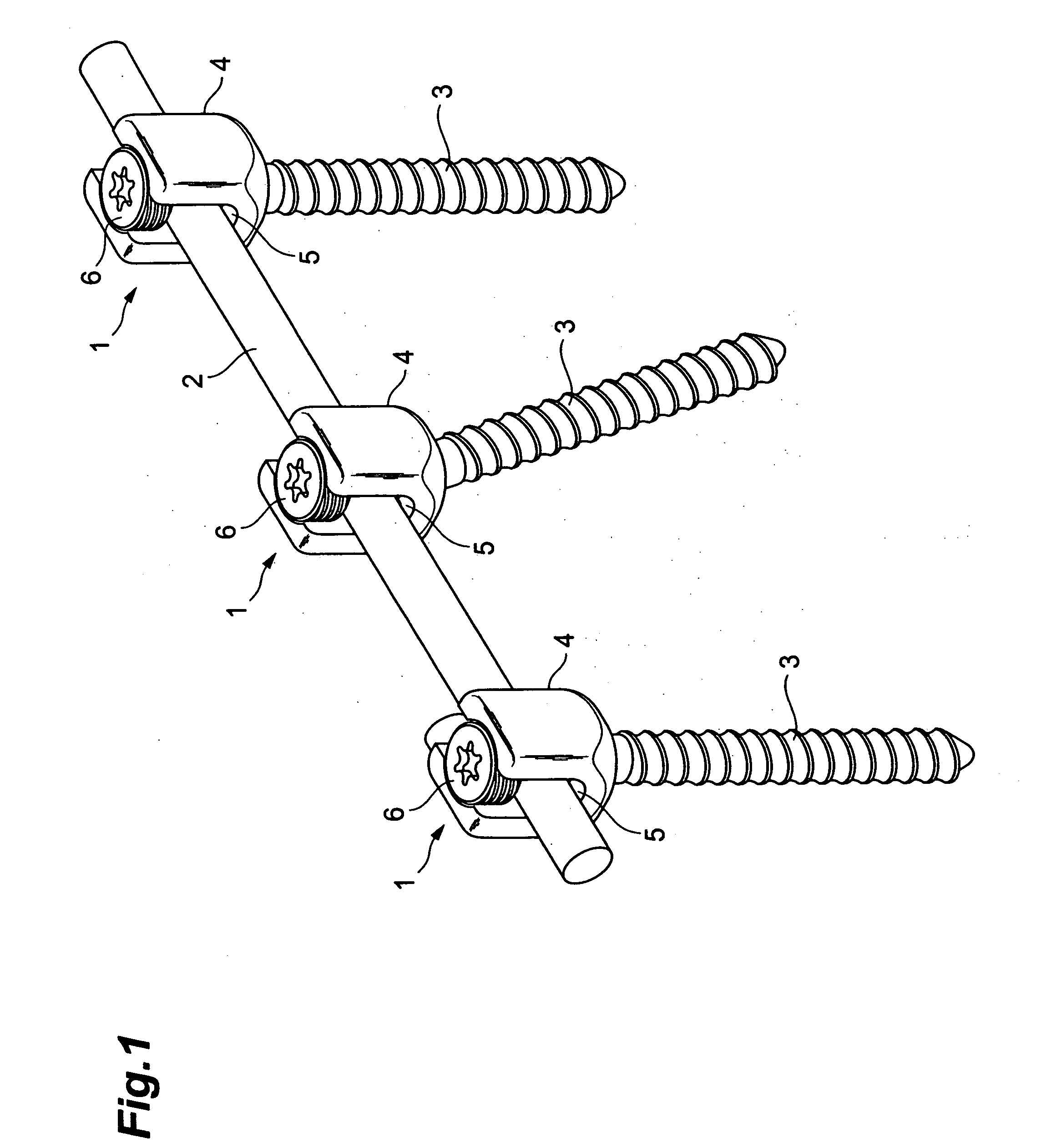 Vertebra connection member