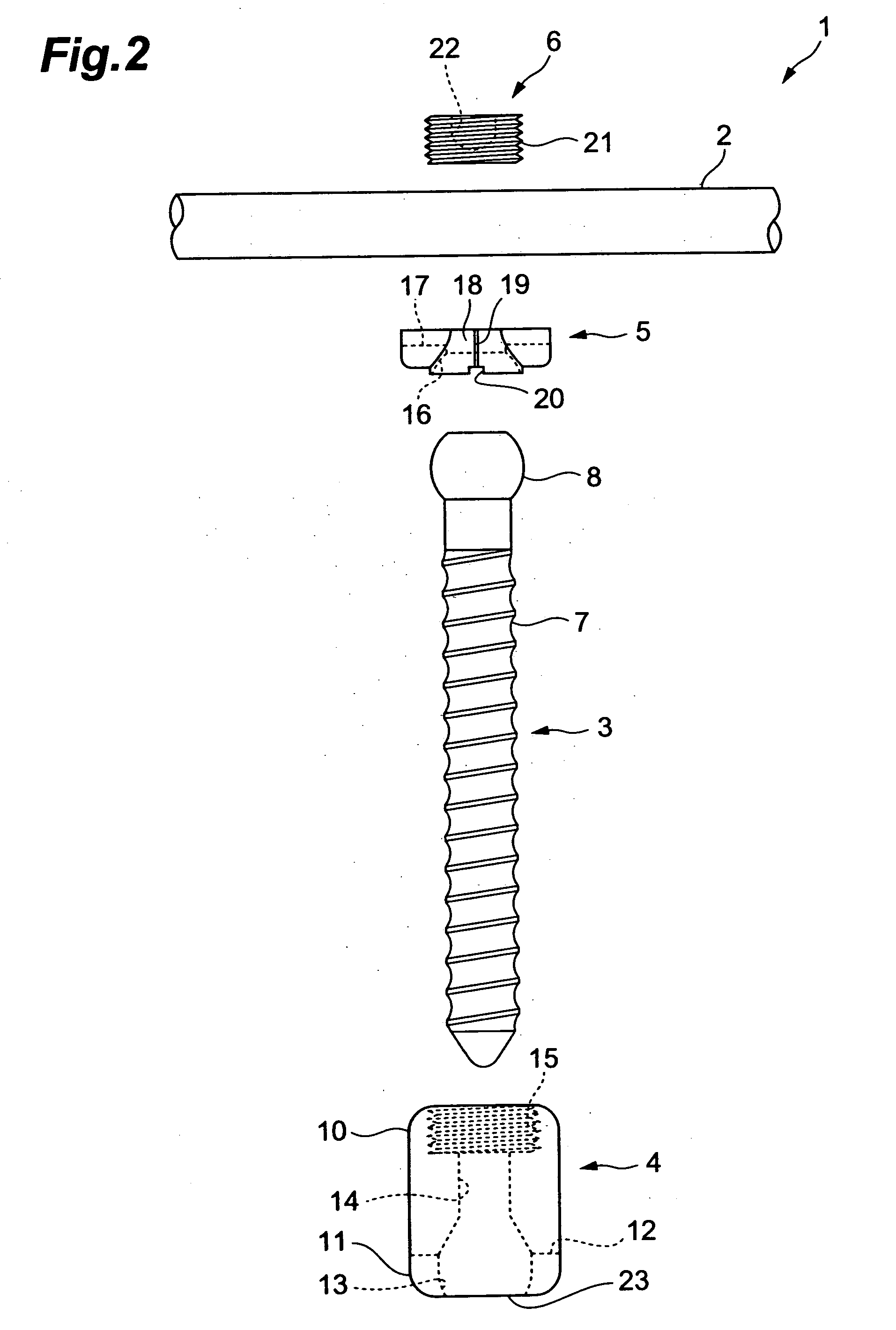 Vertebra connection member