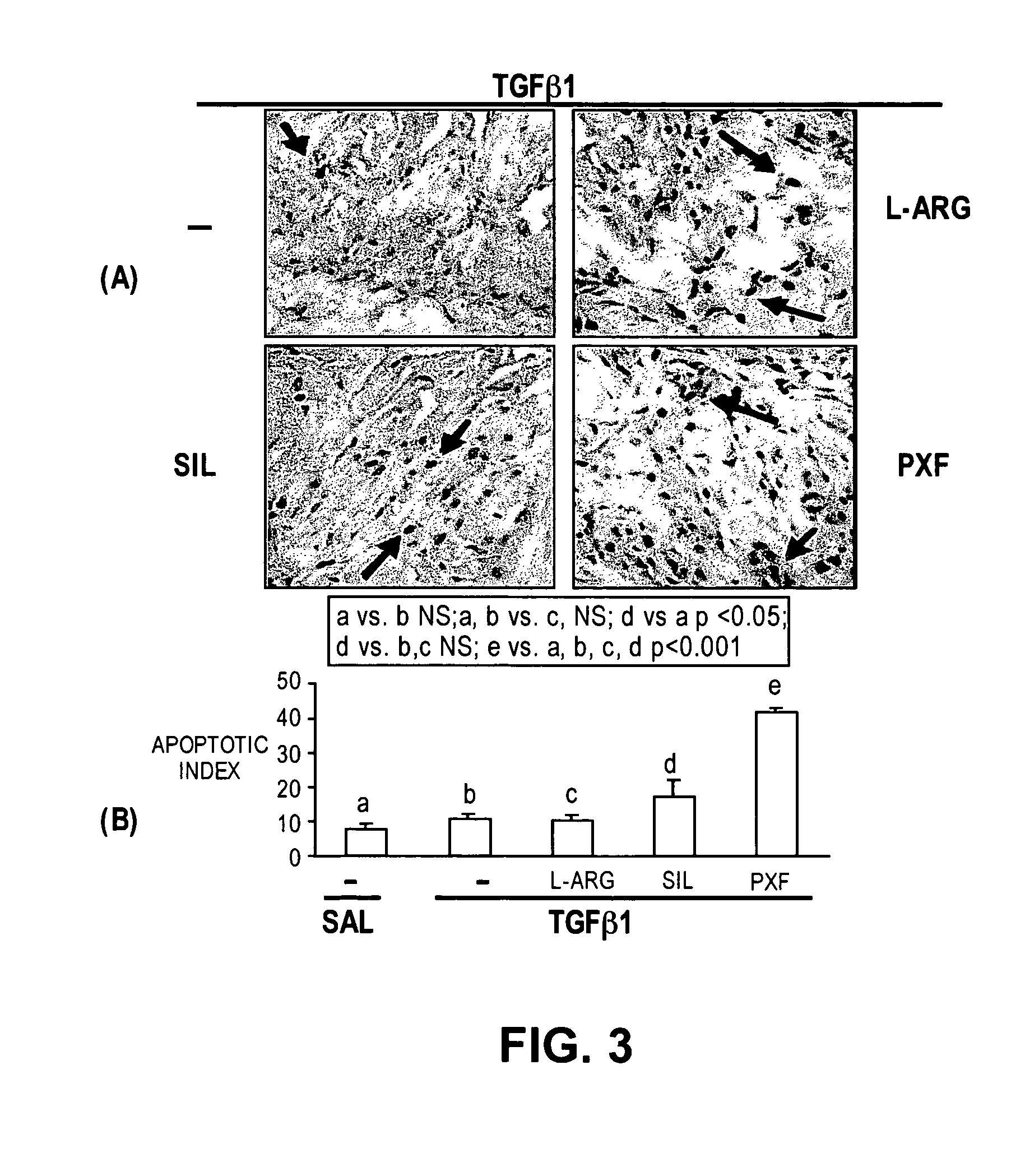 Methods of use of inhibitors of phosphodiesterases and modulators of nitric oxide, reactive oxygen species, and metalloproteinases in the treatment of peyronie's disease, arteriosclerosis and other fibrotic diseases