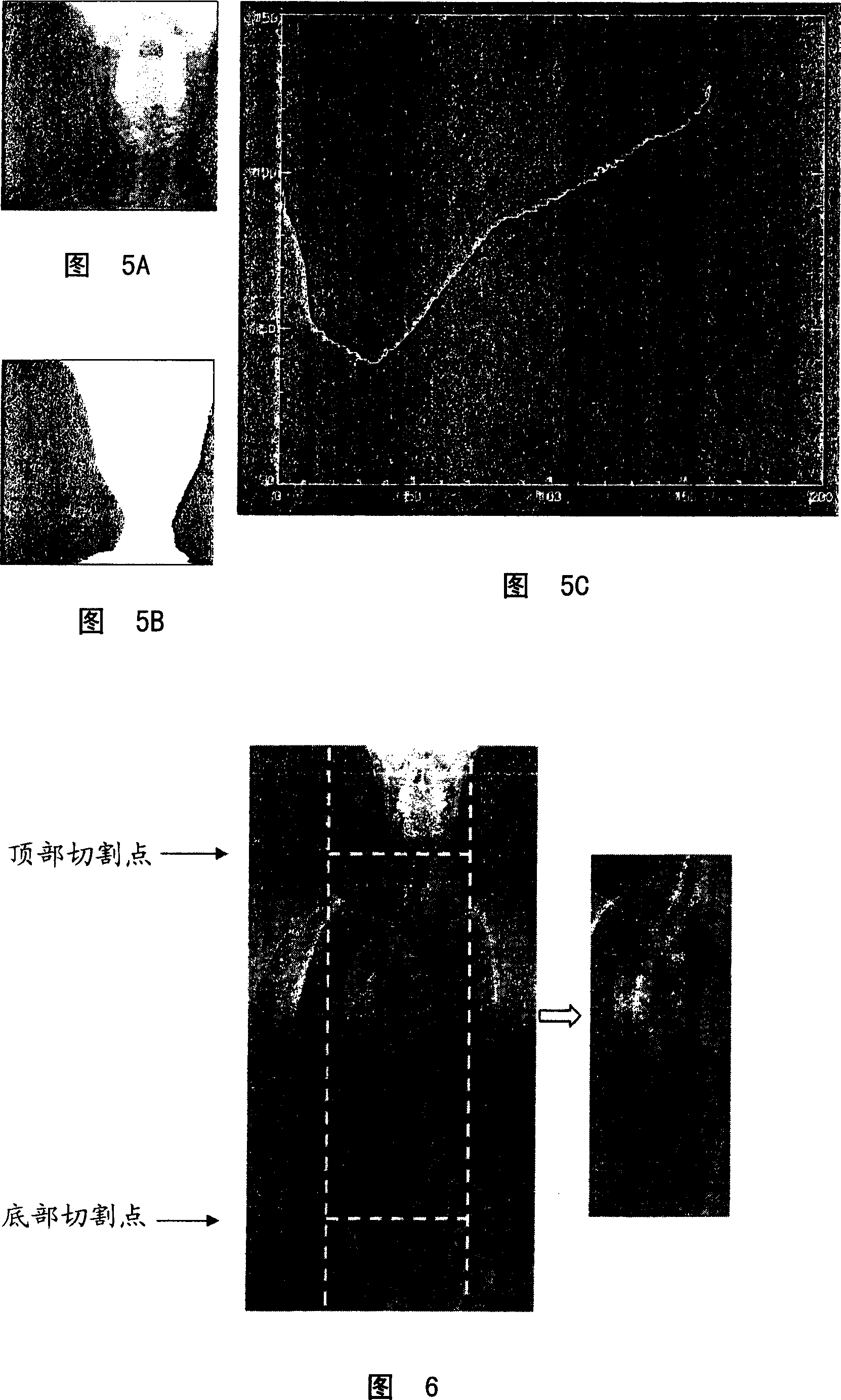 Automatic detection of spinal curvature in spinal image and calculation method and device for specified angle