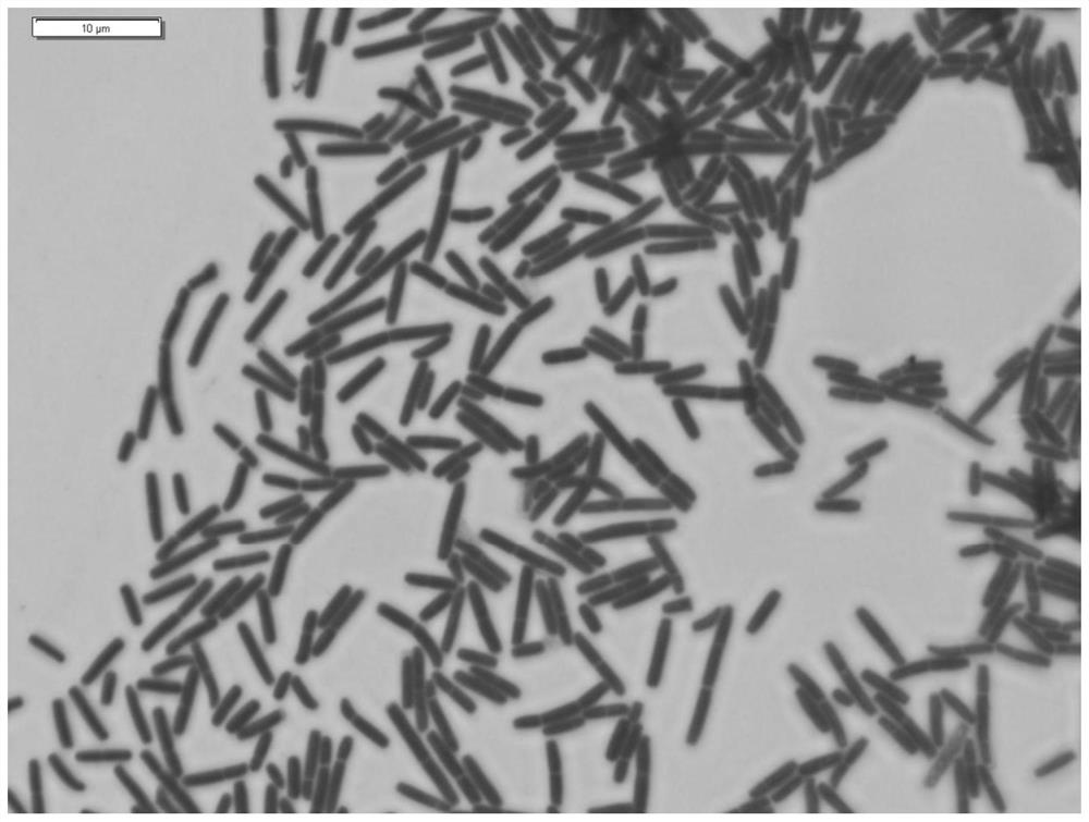 A kind of Lactobacillus helveticus bacterial strain with effect of improving depression and application thereof