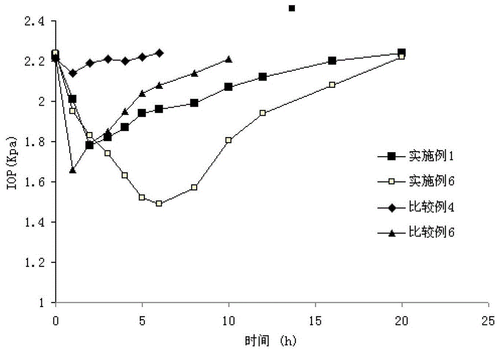 Ophthalmic gel containing travoprost and timolol and preparation method thereof