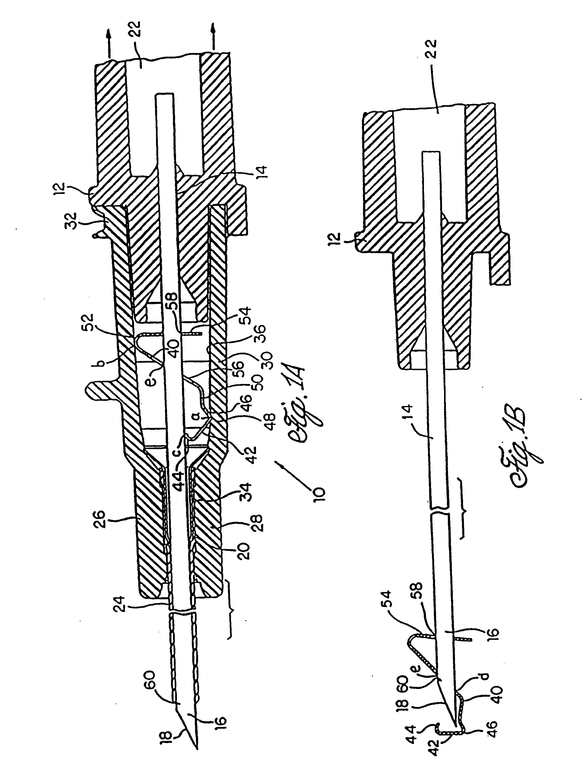 Spring clip safety iv catheter