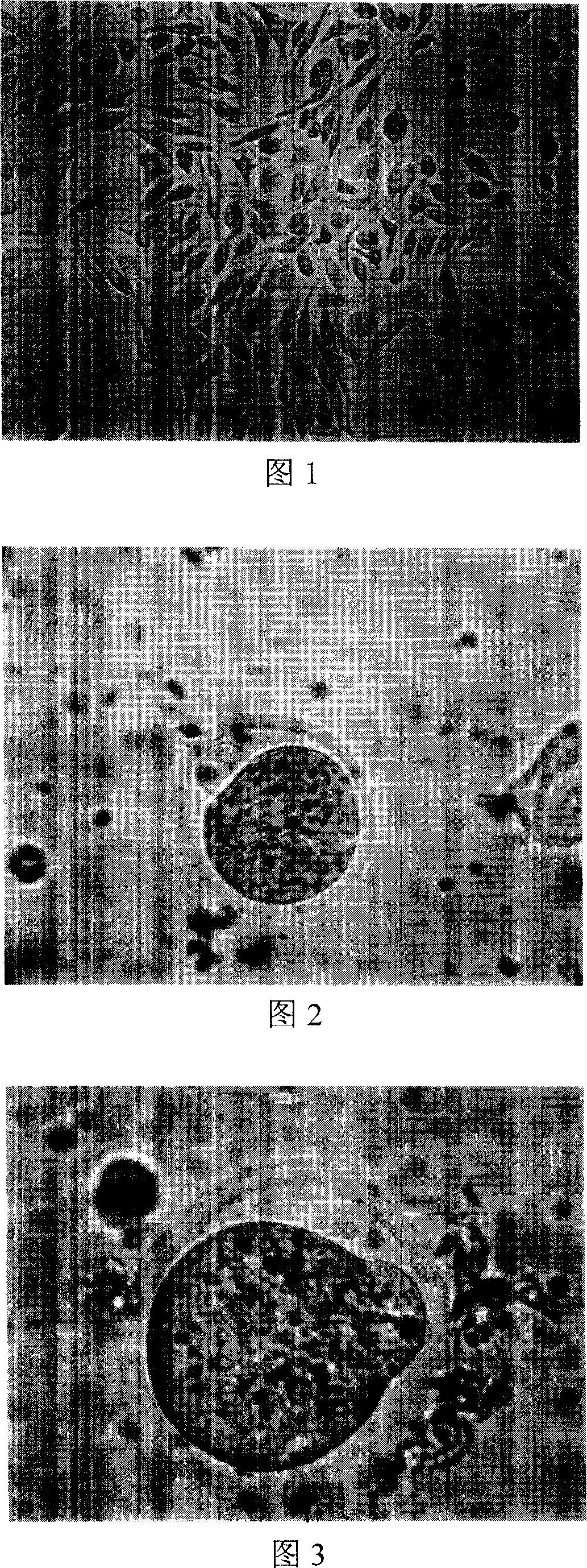 In-vitro cultivating matural process of immatural ovocyte through promoting discharging separating or sucting obtained in ovarium organized