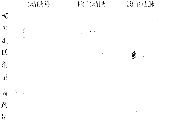 Ligusticum chuanxiong hort extract and preparation method and application thereof