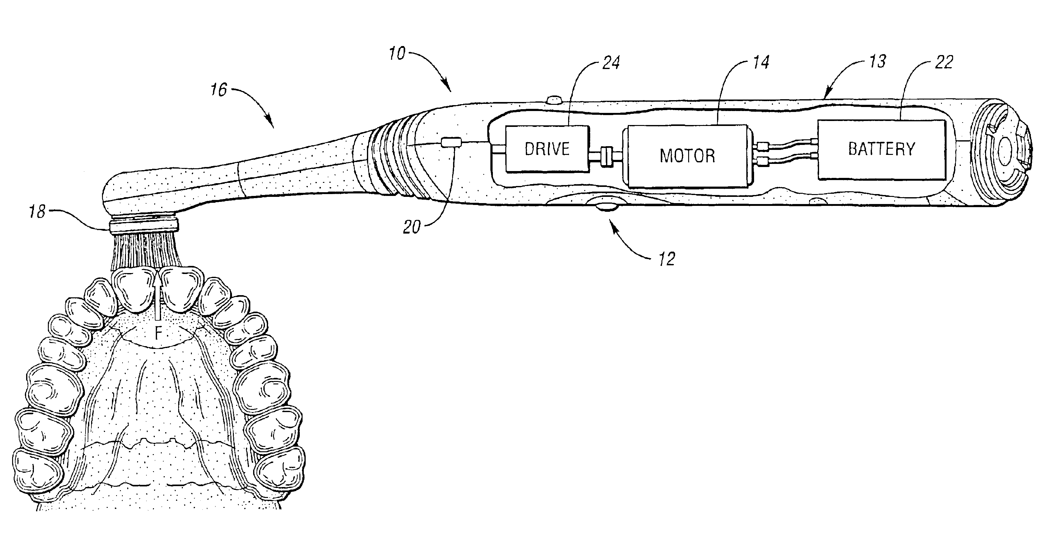 Automatic electric toothbrush