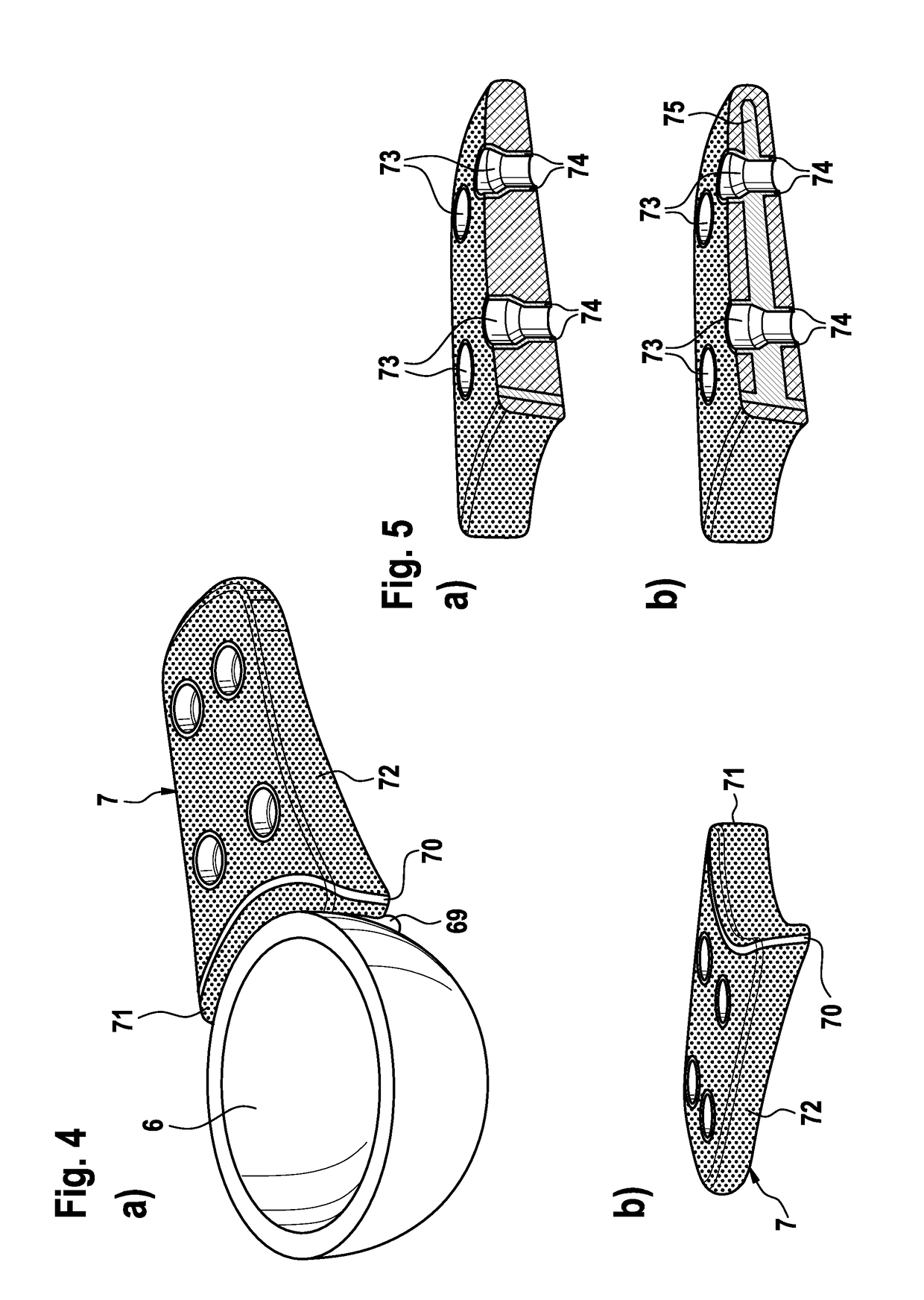 Porous structure for bone implants