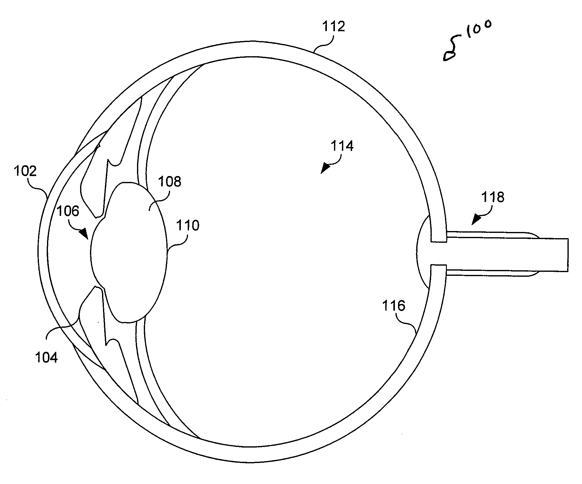 Non-invasive power adjustable intraocular lens