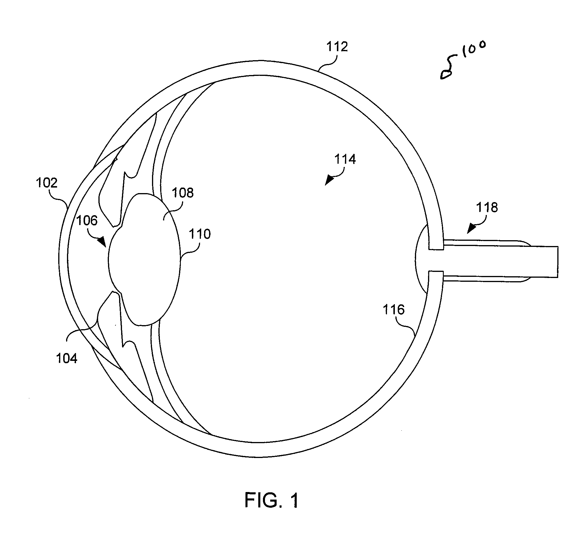 Non-invasive power adjustable intraocular lens