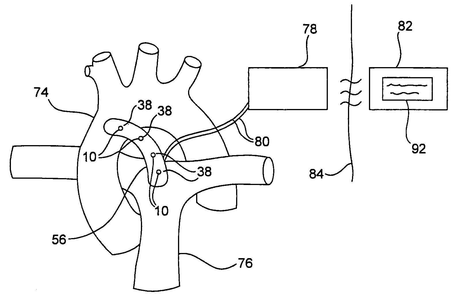 User-retainable temperature and impedance monitoring methods and devices