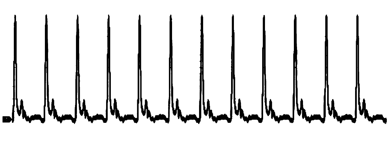 Mamyshev type laser oscillator with nonlinear loop filter