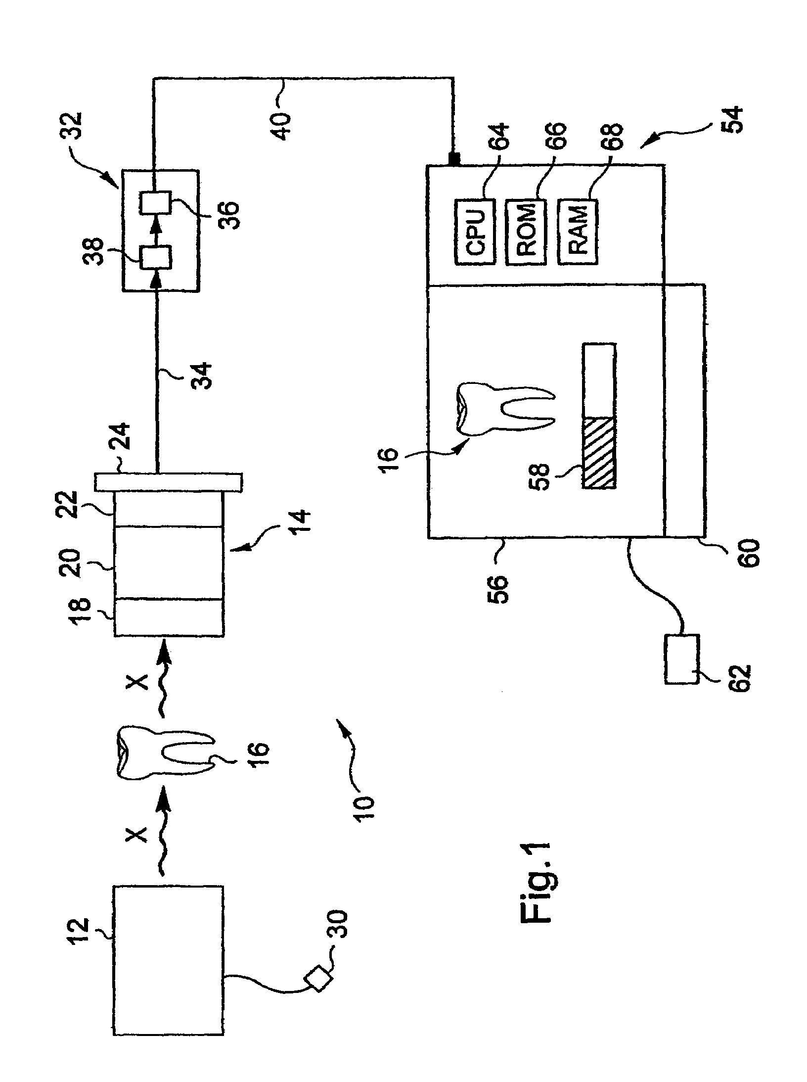 Signal processing method in a dental radiology apparatus