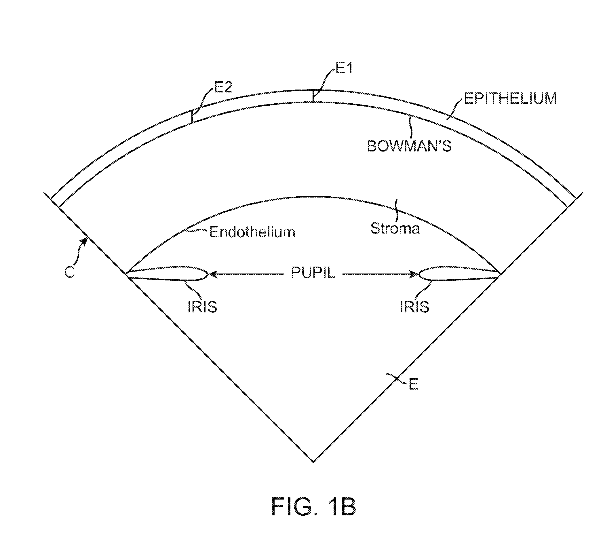 Customized laser epithelial ablation systems and methods