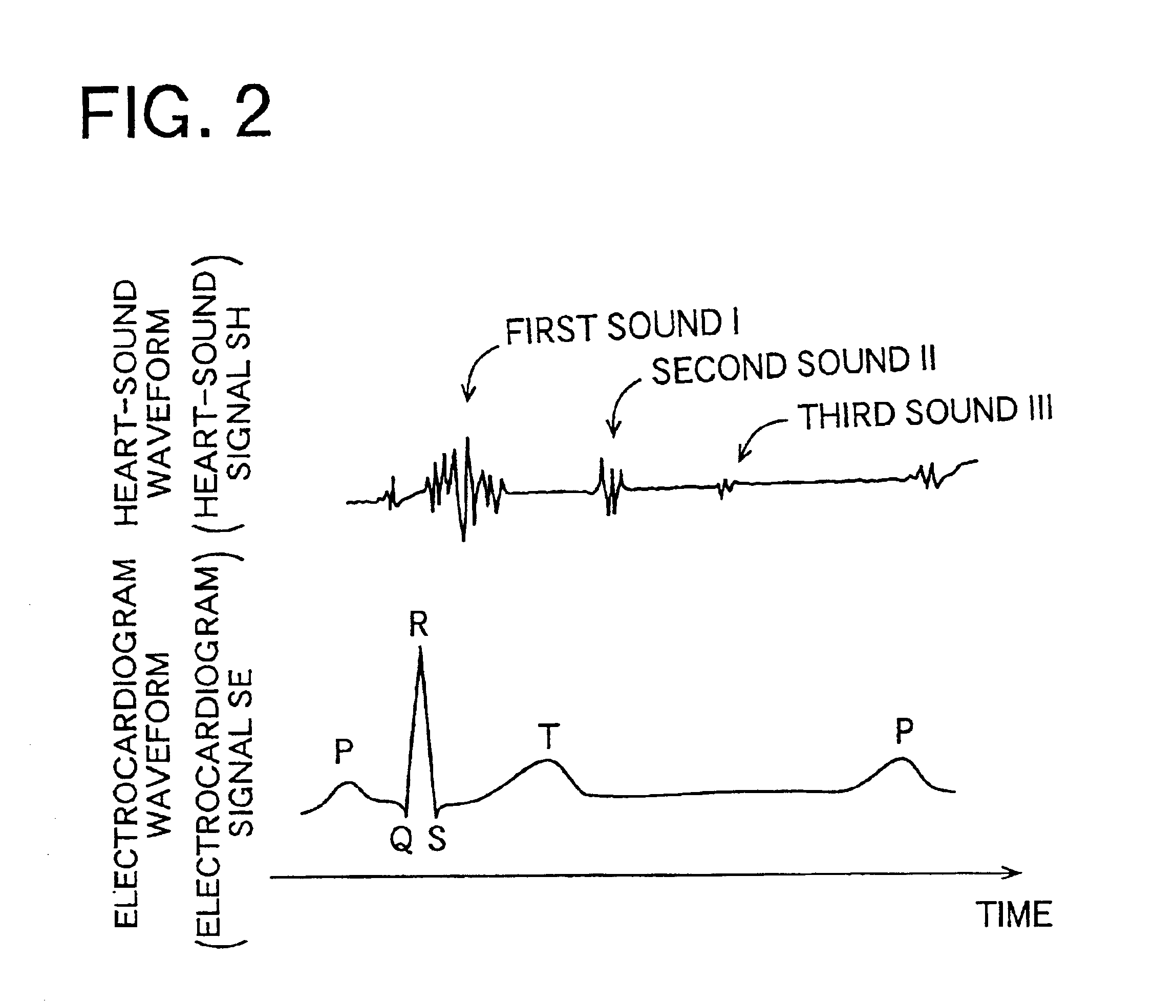 Heart-sound detecting apparatus and pulse-wave-propagation-velocity-relating-information obtaining system using the heart-sound detecting apparatus