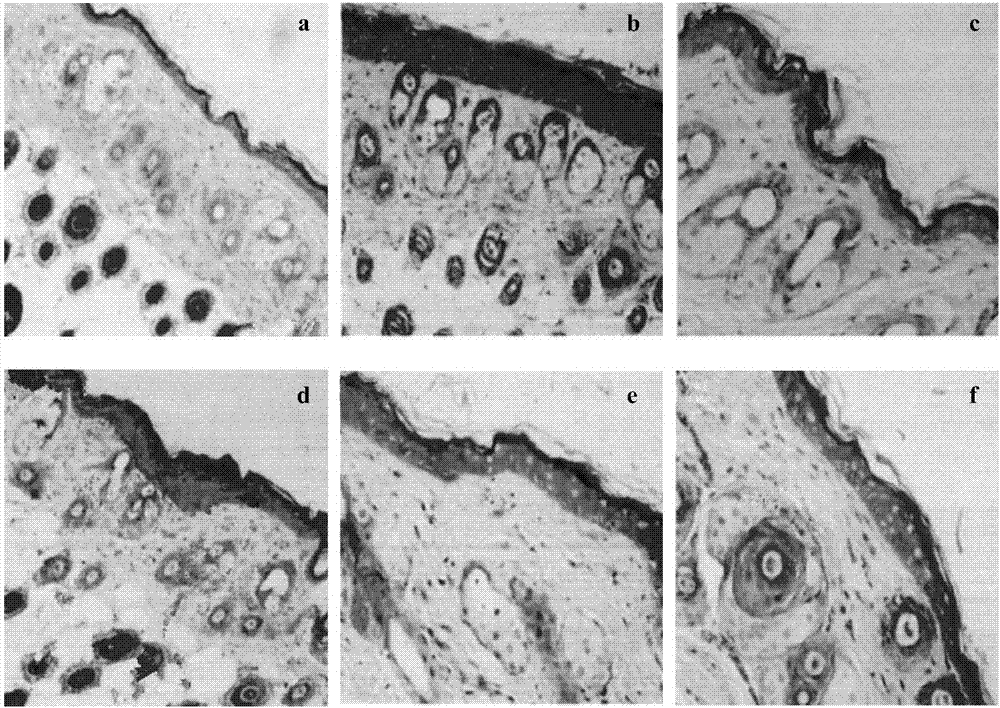 Moisturizing and antioxidant dendrobium officinale-containing skin-care lotion and preparation method thereof