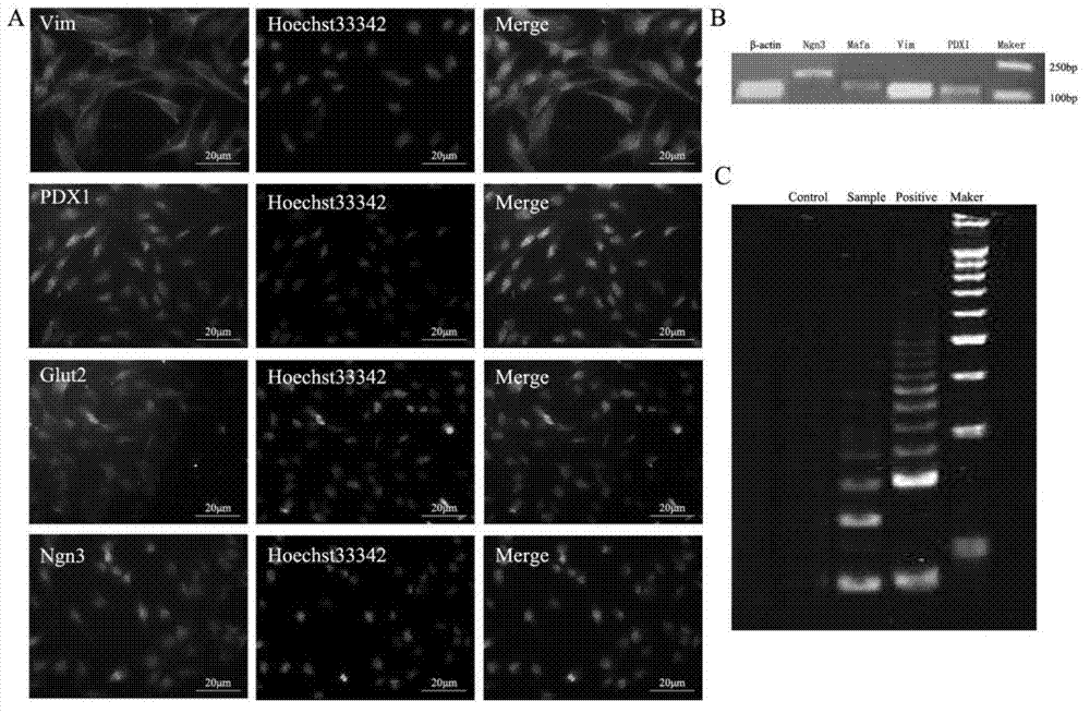 Method for constructing human islet-derived pancreatic stem cell line and method for differentiation of human islet-derived pancreatic stem cell line into insulin-producing cells