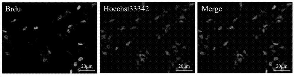 Method for constructing human islet-derived pancreatic stem cell line and method for differentiation of human islet-derived pancreatic stem cell line into insulin-producing cells