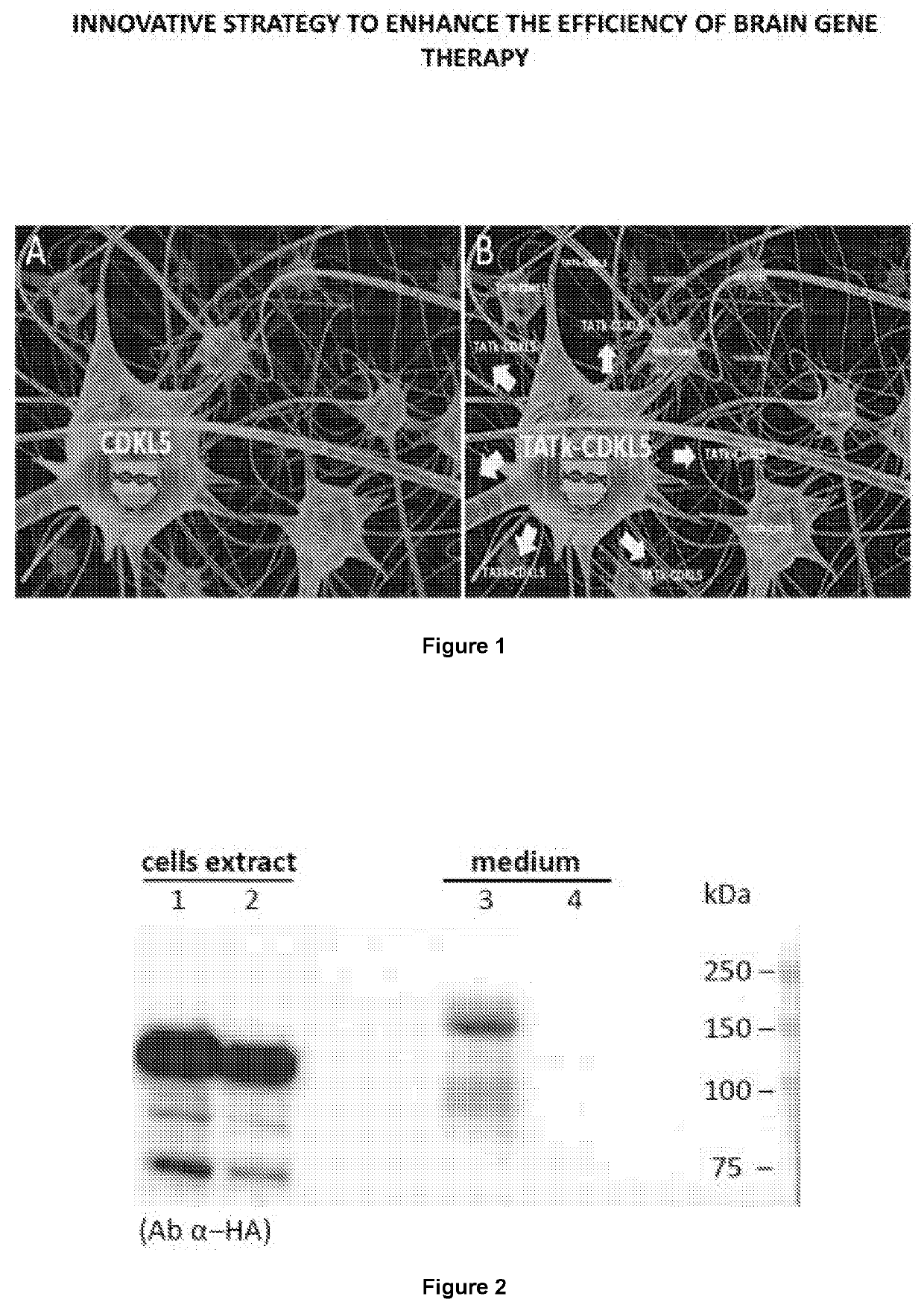 New gene therapy constructs