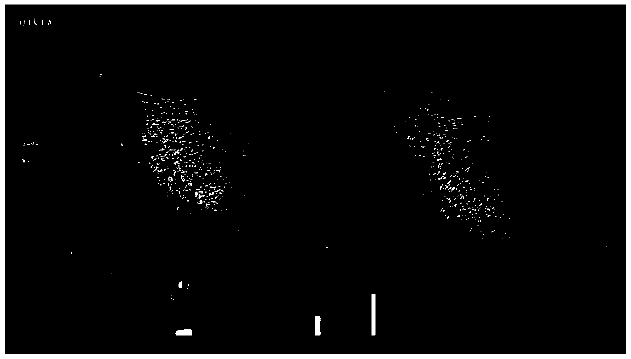 Polypeptide lyophilized powder and application thereof in preparing anti-aging cosmetics