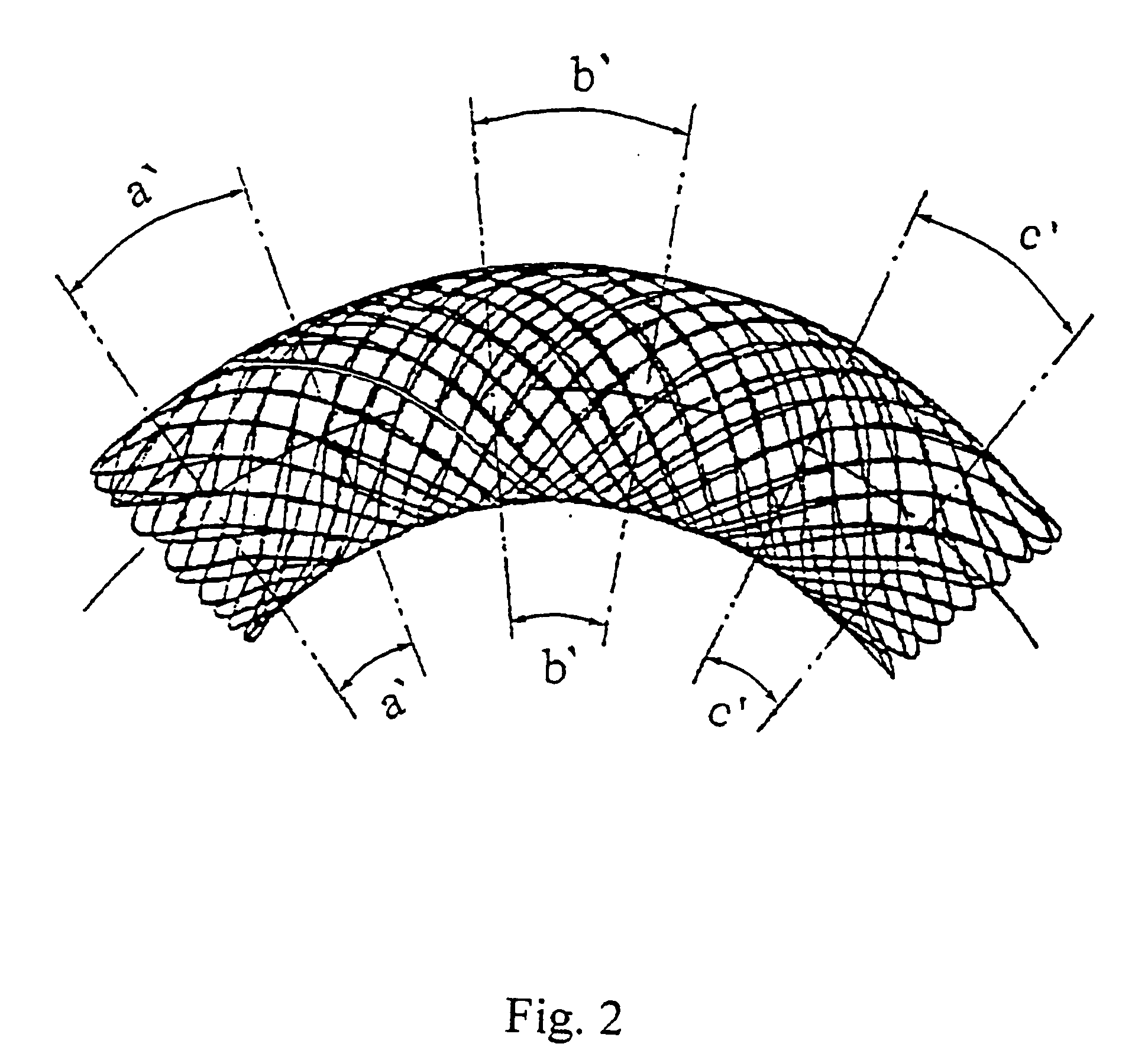 Stent and method for the production thereof (variants)