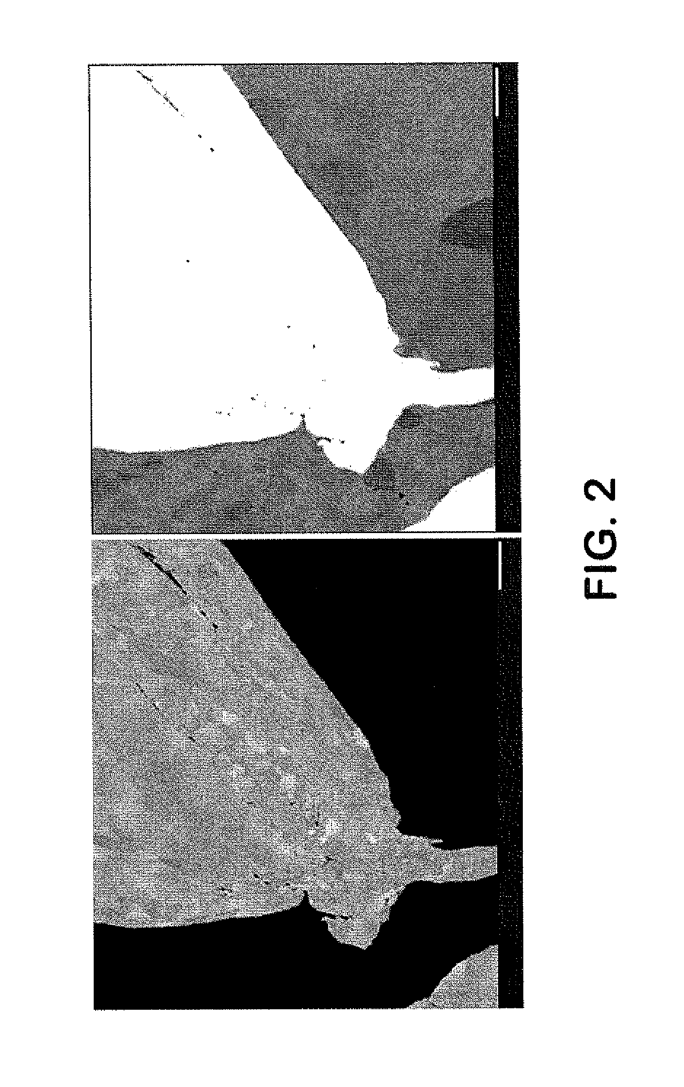 Method of manufacturing bulk metallic structures with submicron grain sizes and structures made with such method