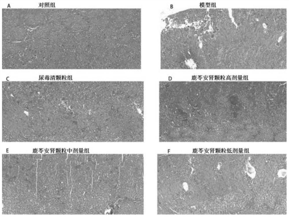 Pharmaceutical composition for chronic renal failure and preparation method and application thereof