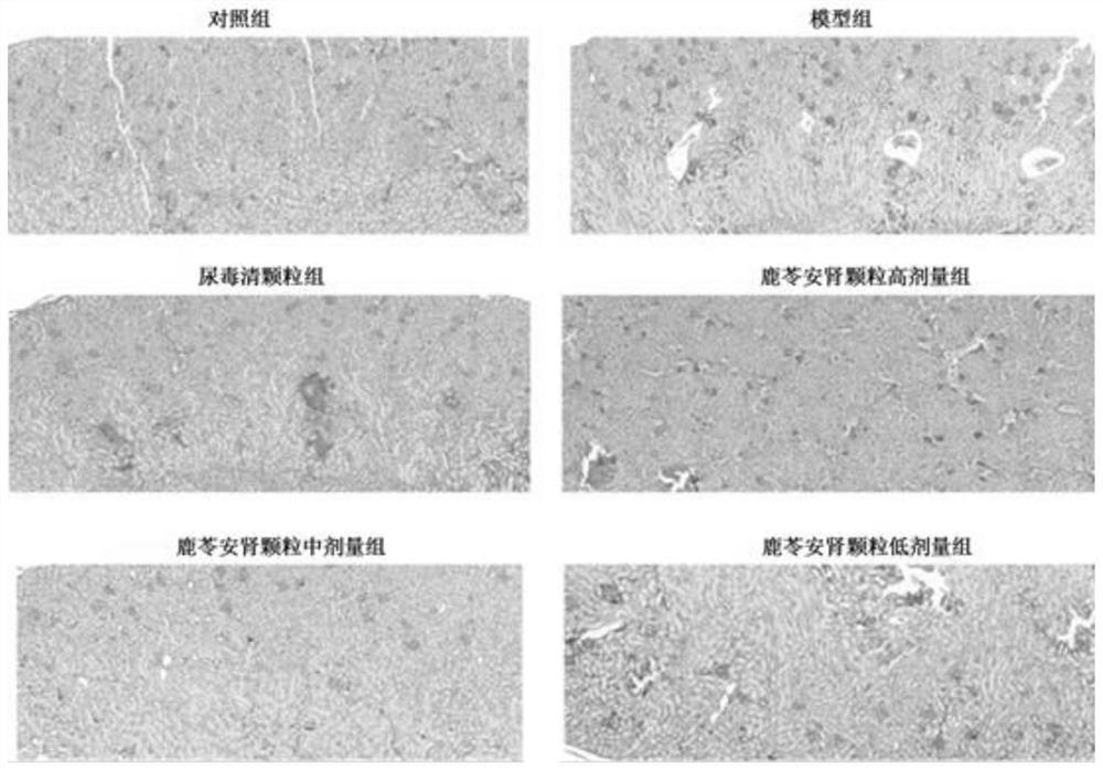 Pharmaceutical composition for chronic renal failure and preparation method and application thereof