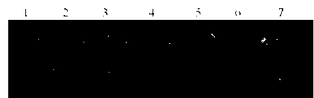 LAMP visual rapid detection kit of silkworm densoviruses and detection method thereof