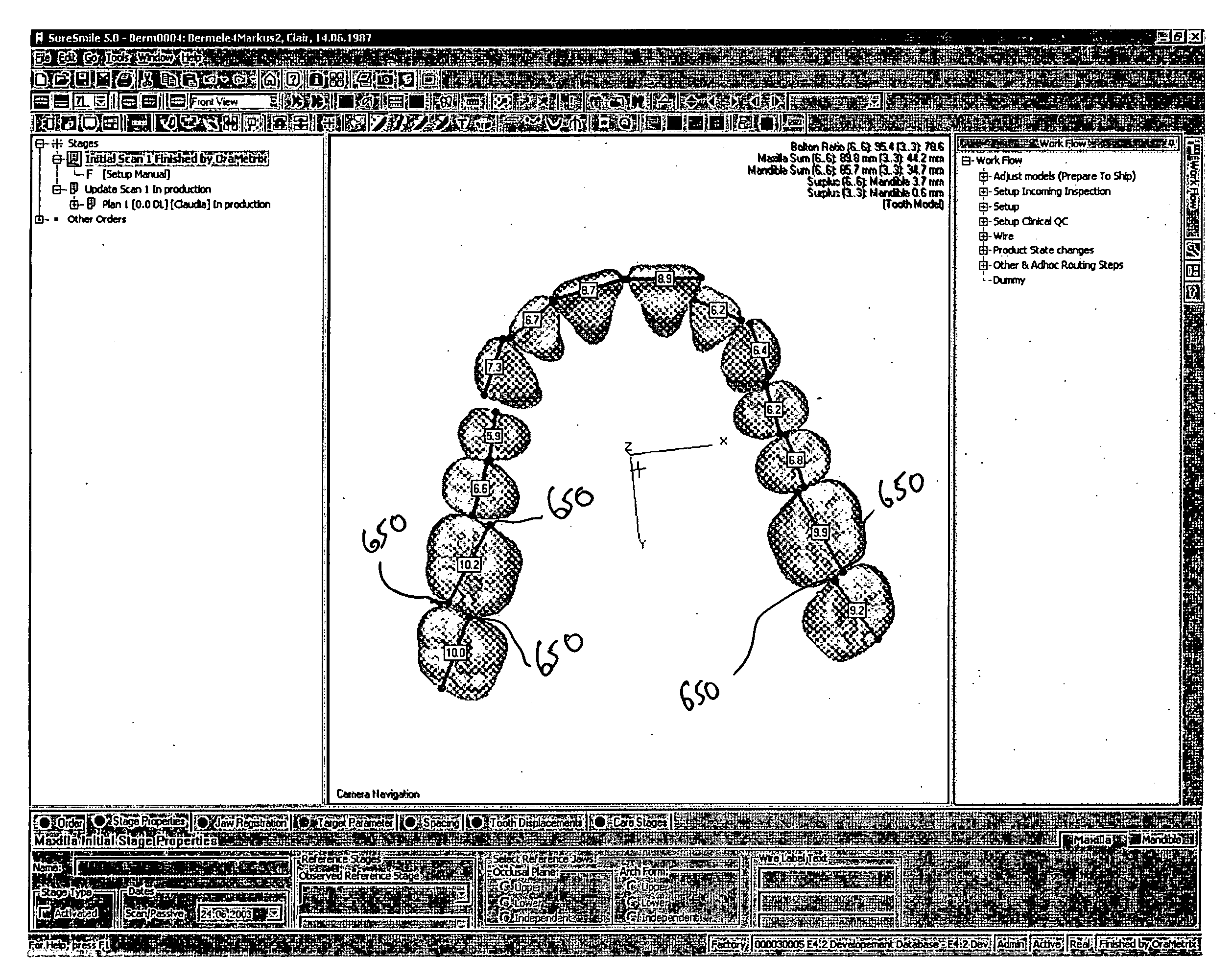 Method and system for finding tooth features on a virtual three-dimensional model