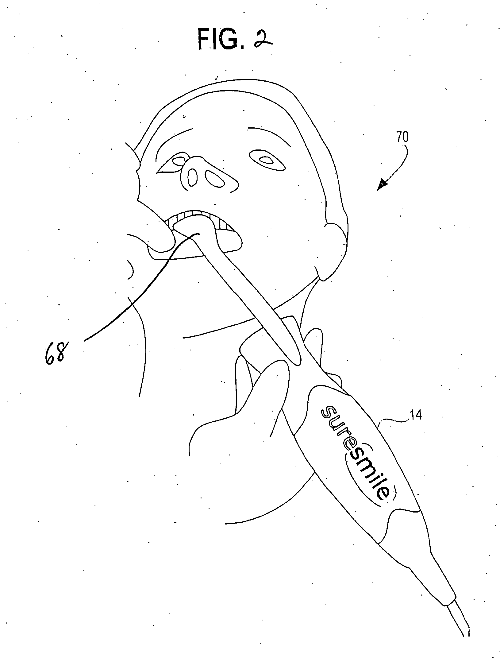 Method and system for finding tooth features on a virtual three-dimensional model