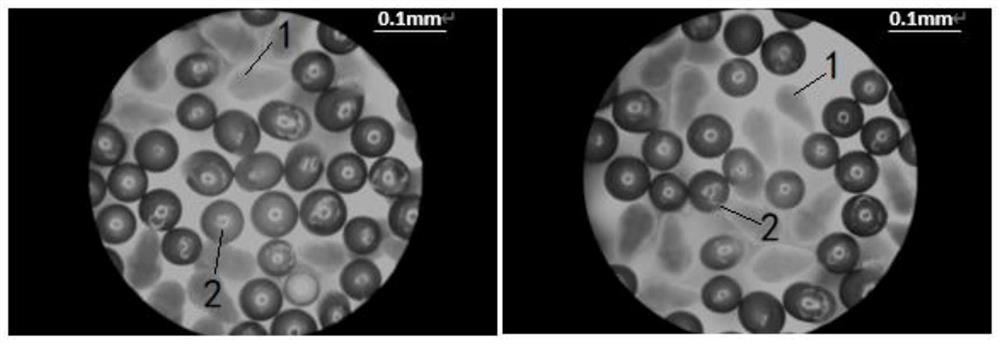 Method for constructing diabetic zebrafish model