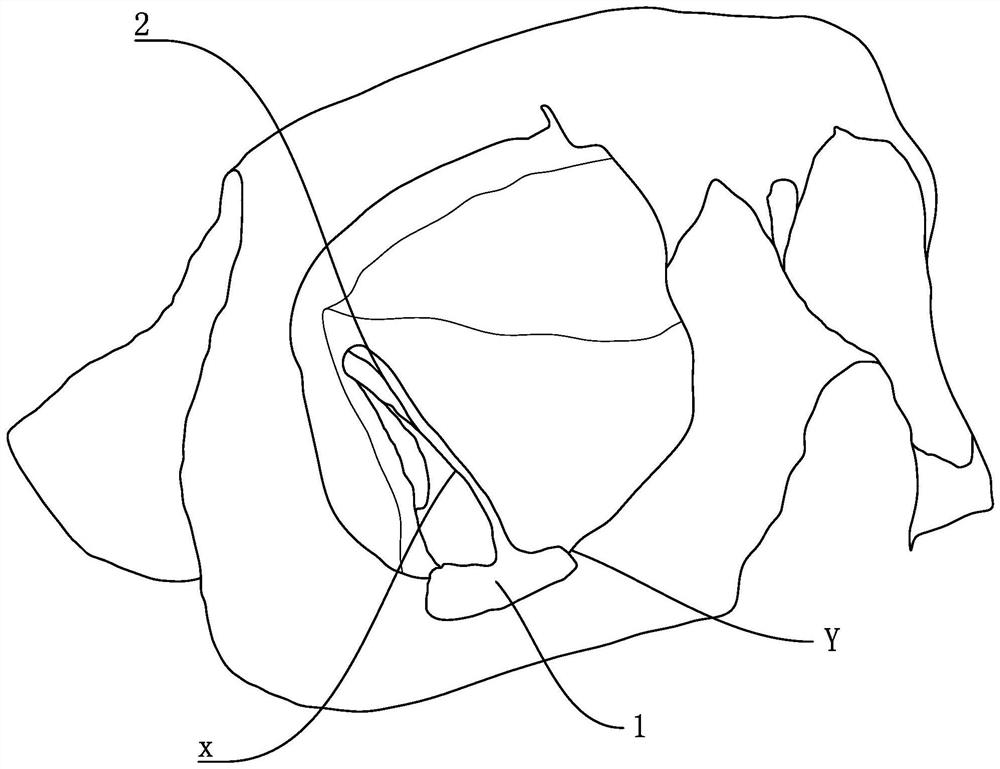 Positioner for orbital wall decompression surgery under endoscope