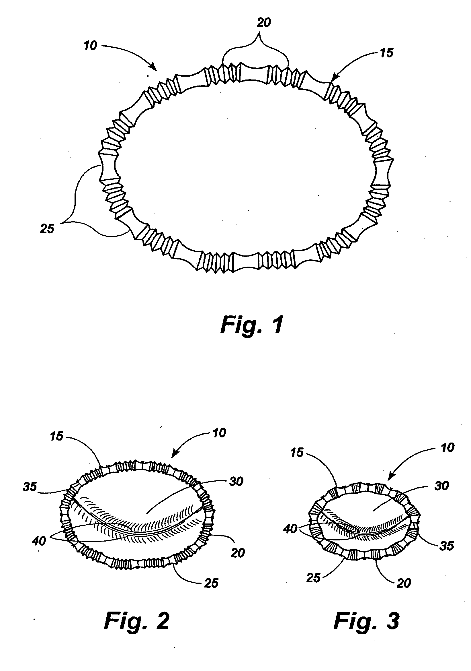 Methods and apparatus for controlling the internal circumference of an anatomic orifice or lumen