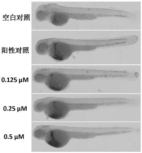 Snake venom prothrombin activator and snake venom prothrombin activator-based fast hemostatic material