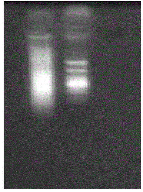 A set of primers, detection method and application for detecting the polymorphism of P.