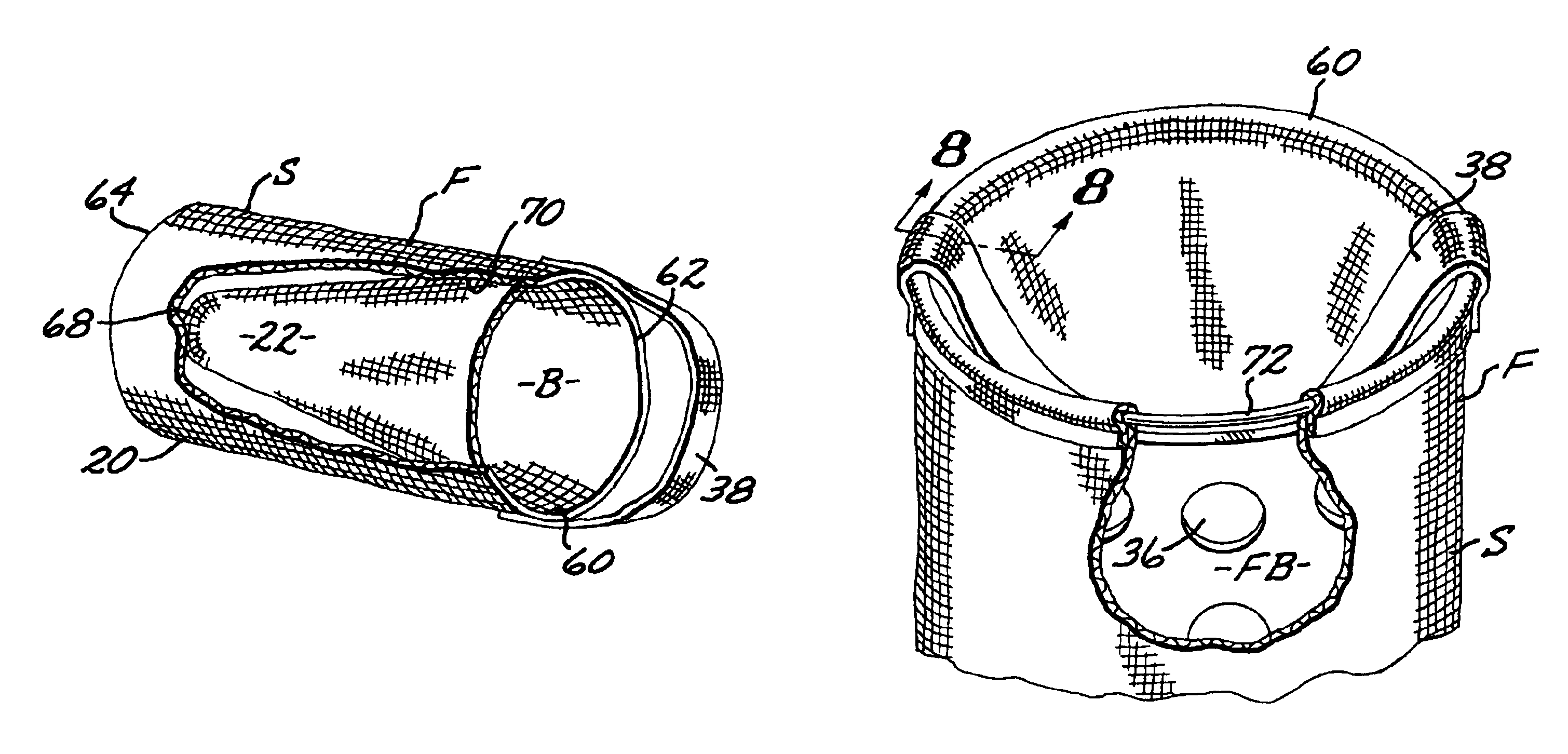 Spa and pool filter