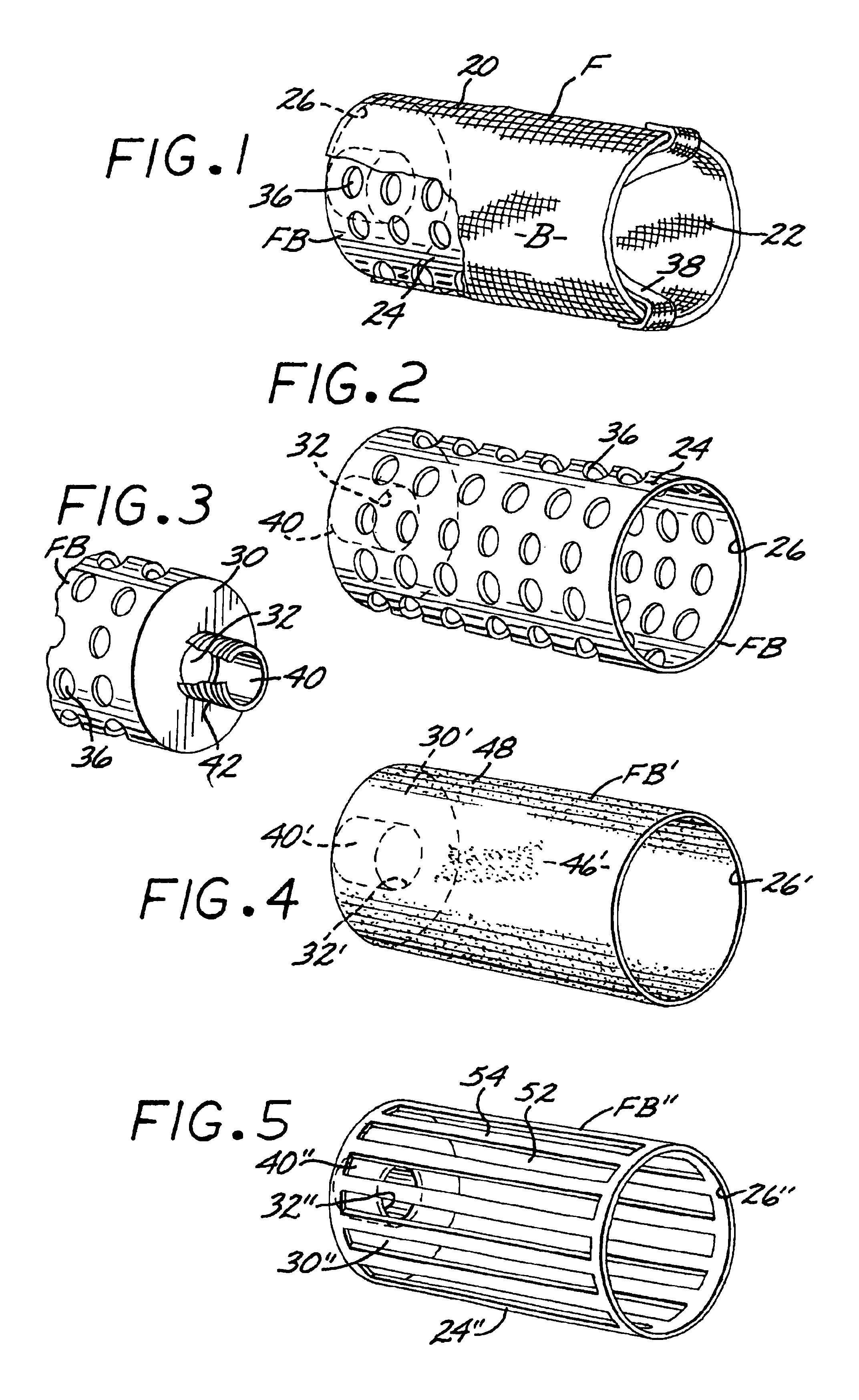 Spa and pool filter