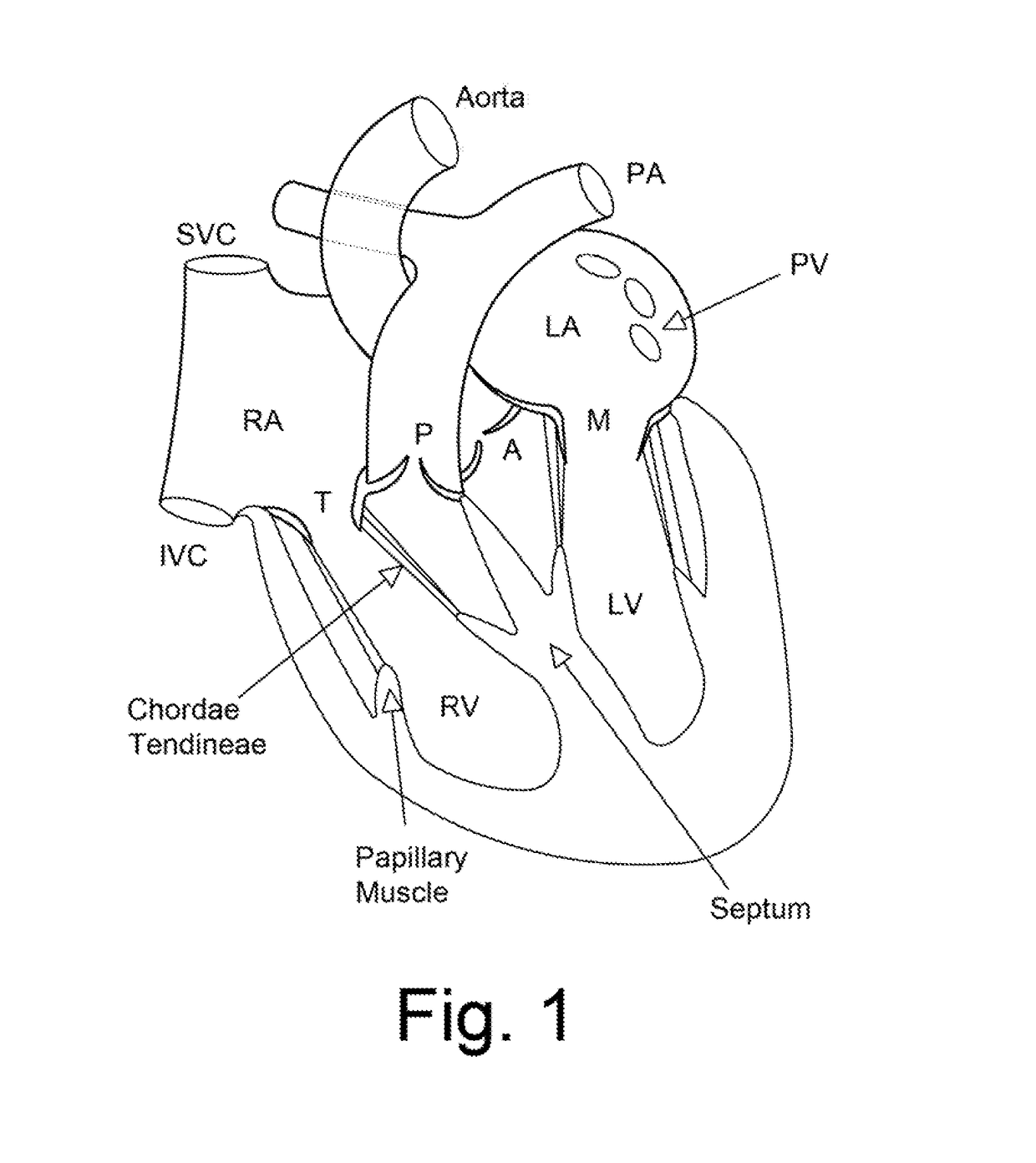 Combined B-mode / tissue doppler approach for improved cardiac motion estimation in echocardiographic images