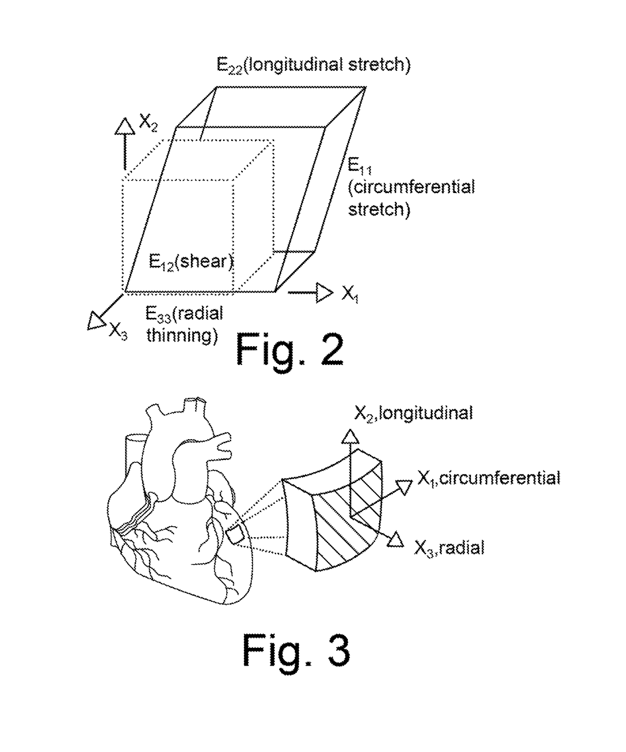 Combined B-mode / tissue doppler approach for improved cardiac motion estimation in echocardiographic images