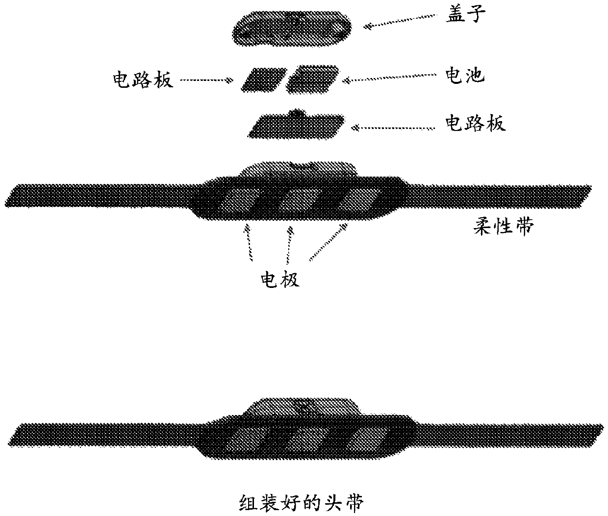 Device and system for monitoring and treating muscle tension-related medical conditions